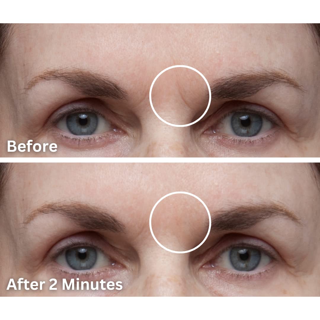 Dermaflage Facial Toner, Medium, 4 Piece