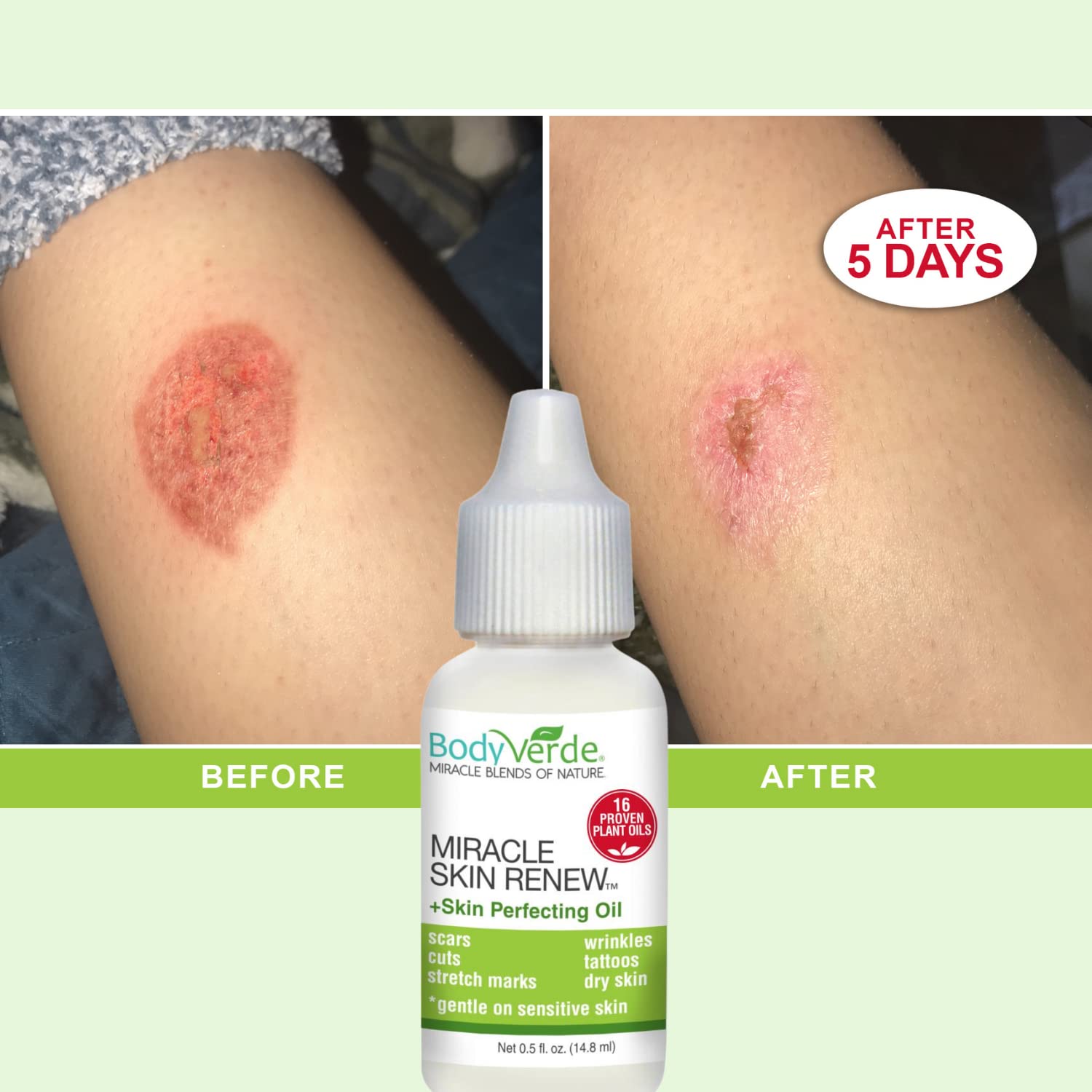 BodyVerde Miracle Skin Renewal Natural Skin Care Product, Skin Repair for Children and Adults, Healing Jojoba Oil and Coconut Oil Serum, Skin Perfecting Oil, 16 Proven Plant Oils, 0.5-Ounce
