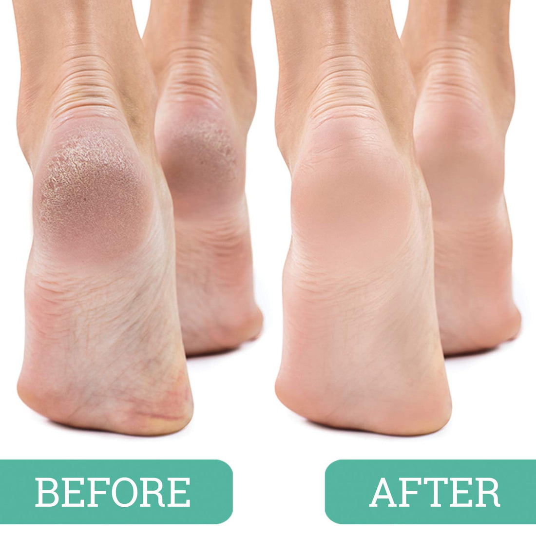 Maccibelle Salon Foot Pumice and Scrubber for Feet and Heels Callus and Dead Skins, Safely and Easily eliminate Callus and Rough Heels (Pack of 4)