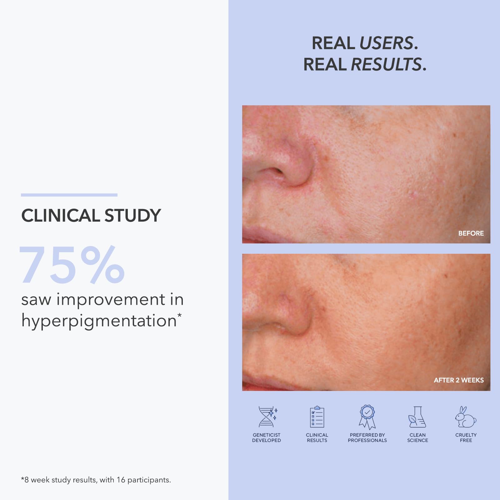 Hydropeptide LUMAPRO-C Skin Brightening Pigment Corrector 1 fl oz