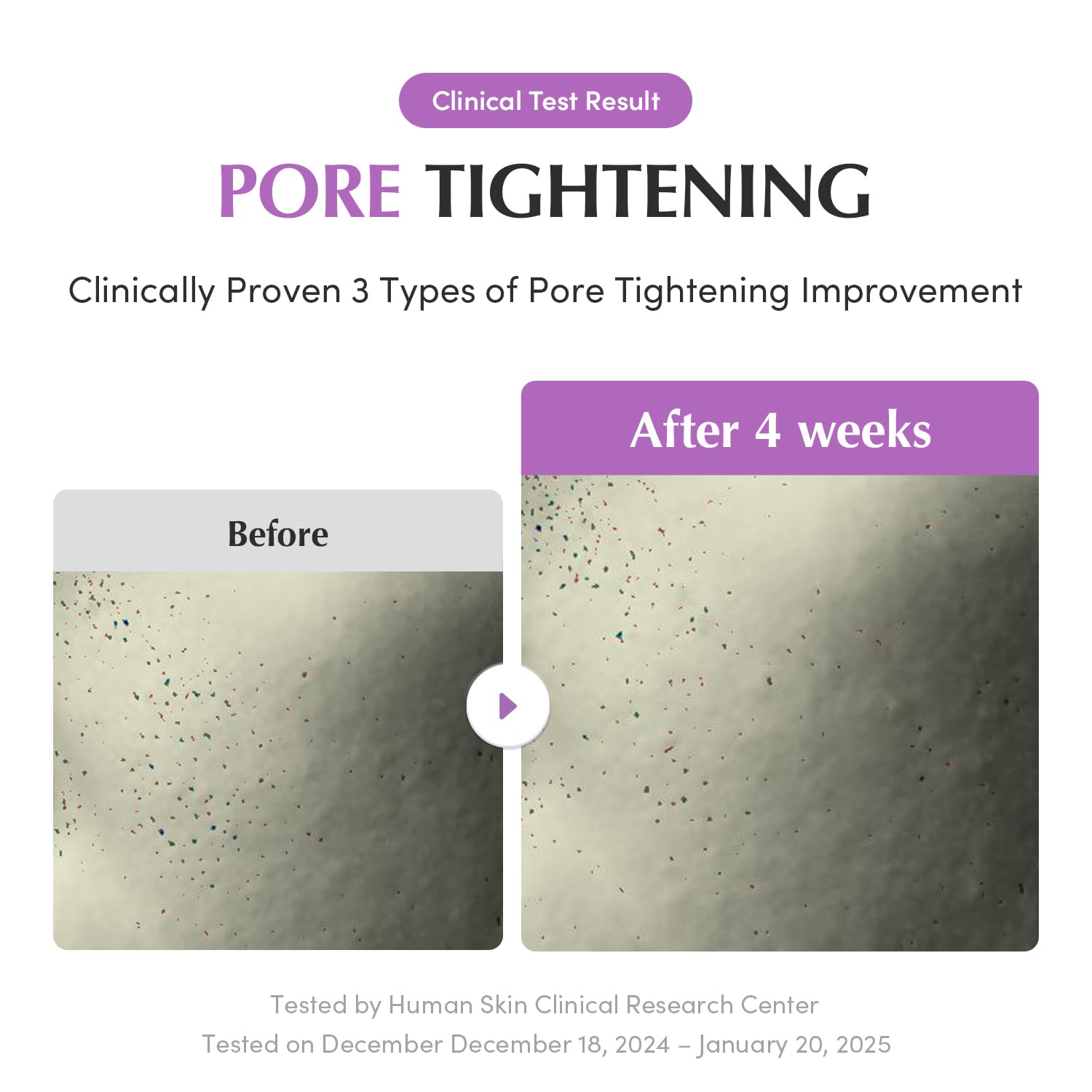 EQQUALBERRY Purple Rice Pore Smoothing Cleansing Oil – Deep Cleansing for Pores & Blackheads | Korean Oil Cleanser for Face & Makeup Remover | Hydrating & Soothing Formula, 6.76 fl.oz