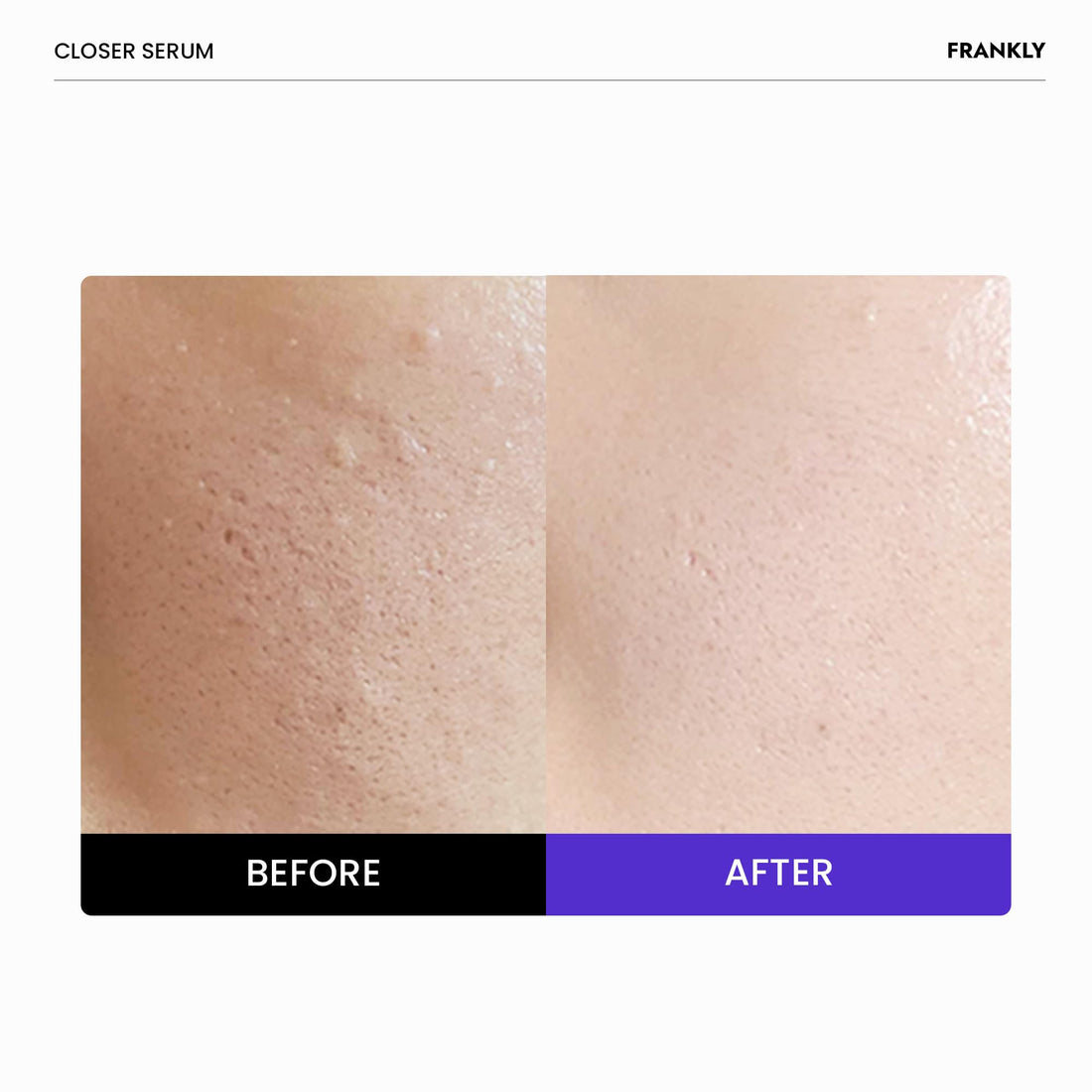 FRANKLY Closer Serum | Pore Minimizer Serum | 9 Peptides, Vegan Collagen, Adenosine, PHA | Korean Pore Minimizer for Glass Skin, Anti-Aging, Hydration, Elasticity | 1.01 fl oz