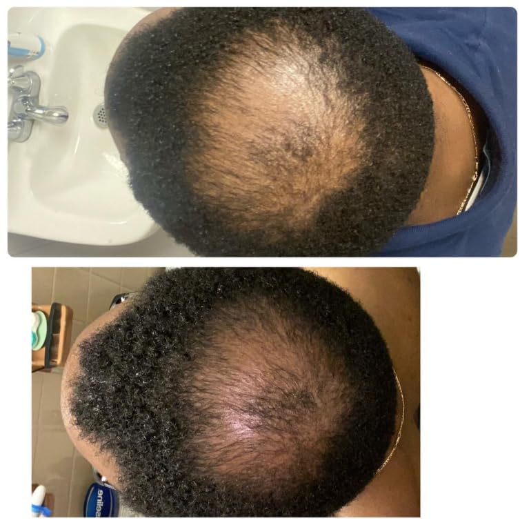 Kreyol Essence Handmade Haitian Black Castor Oil Growth Shampoo