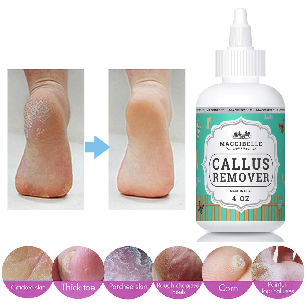 Maccibelle Callus Remover EXTRA STRENGTH Callus Eliminator For Feet, Professional Callus and Corn Eliminator Gel 4 oz