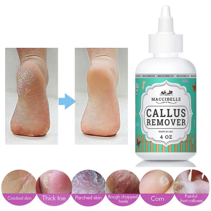 Maccibelle Callus Remover EXTRA STRENGTH Callus Eliminator For Feet, Professional Callus and Corn Eliminator Gel 4 oz