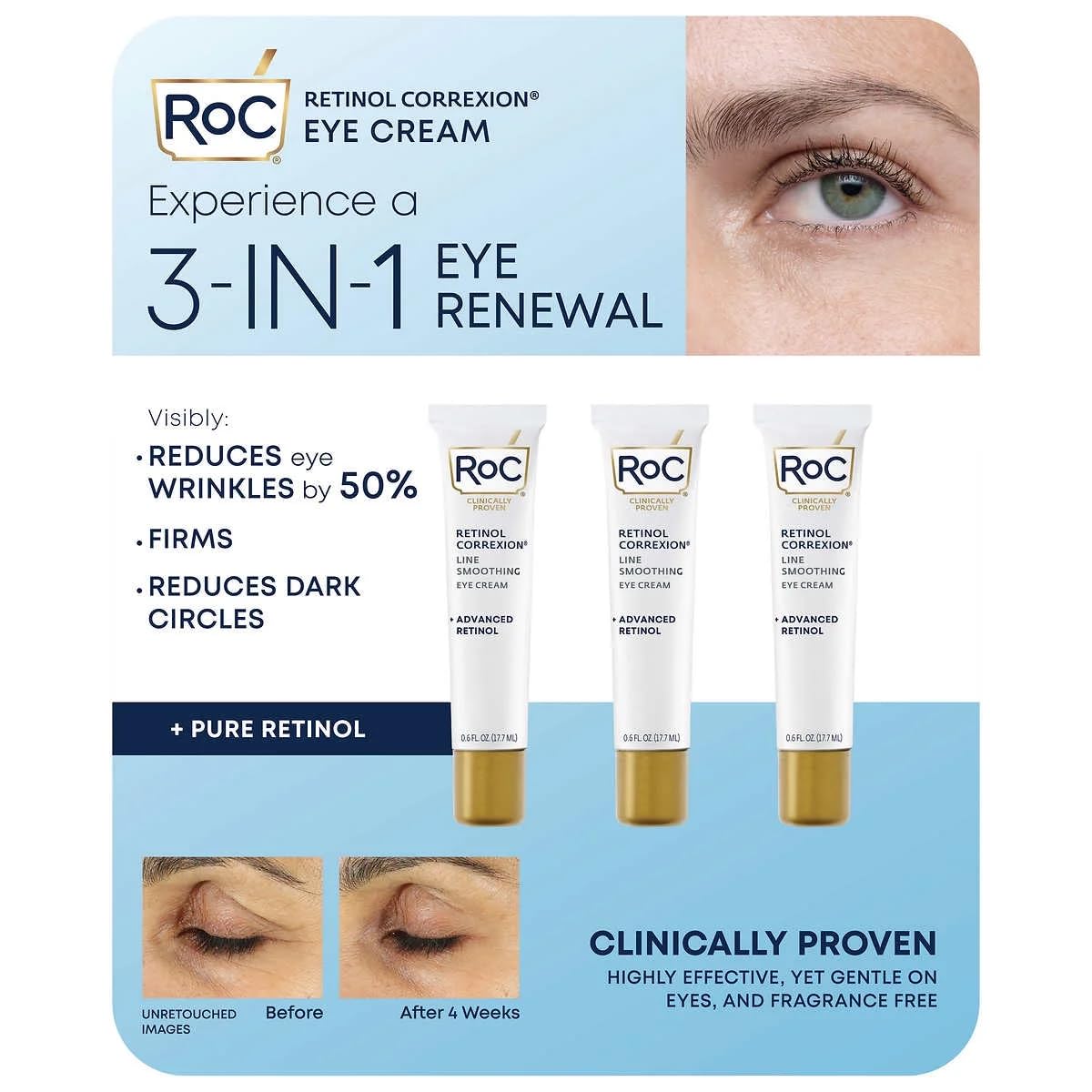 Eye See RoC Line Smoothing Eye Cream, 0.6 Fluid Ounce (Pack of 3)