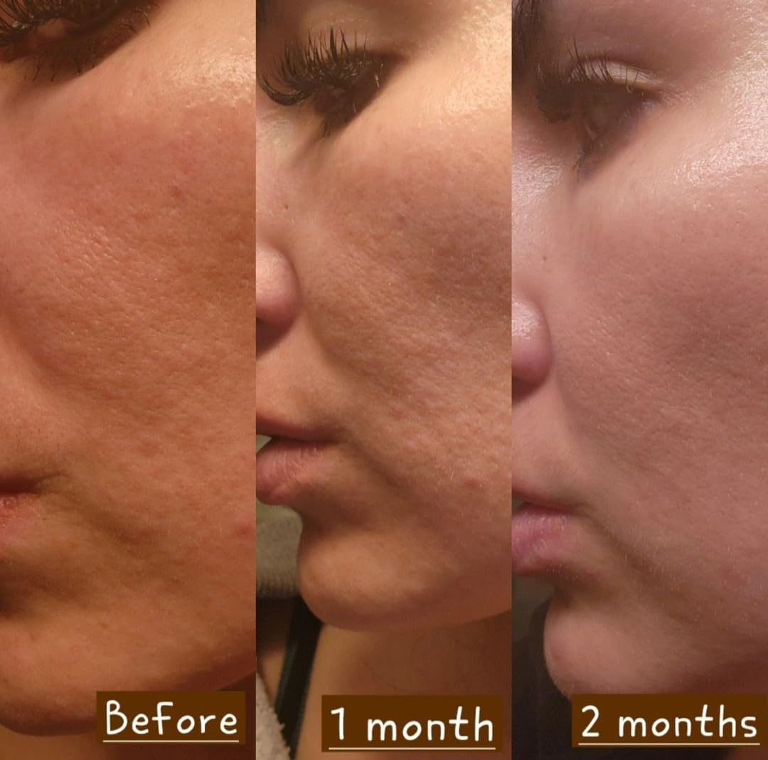 Rejuvenating Facial Night Cream with Retinol, Tepezcohuite, Niacinamide - cruelty-free, vegan, paraben-free silicone-free Mexican Natural skincare ingredients