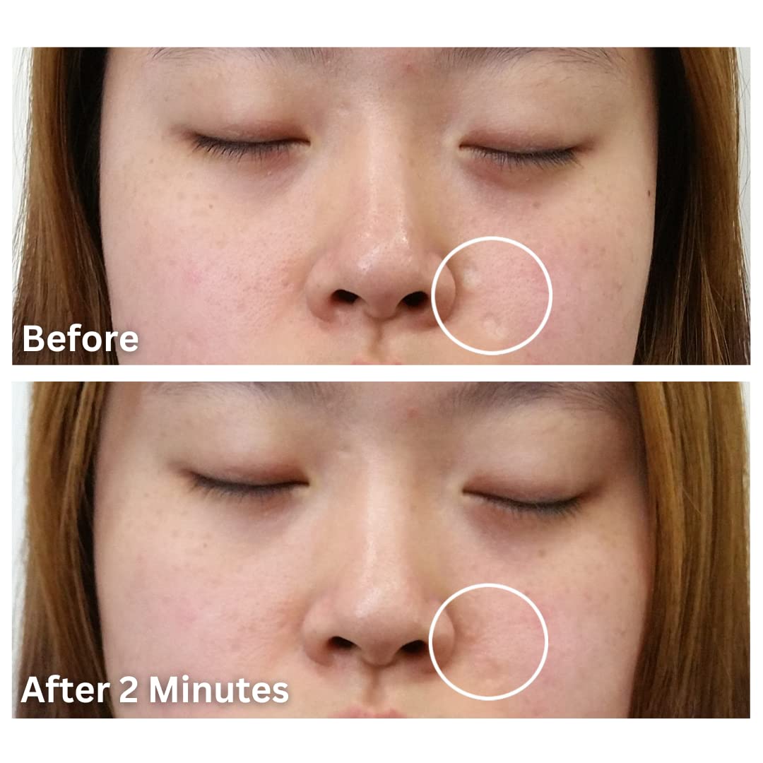 Dermaflage Facial Toner, Medium, 4 Piece