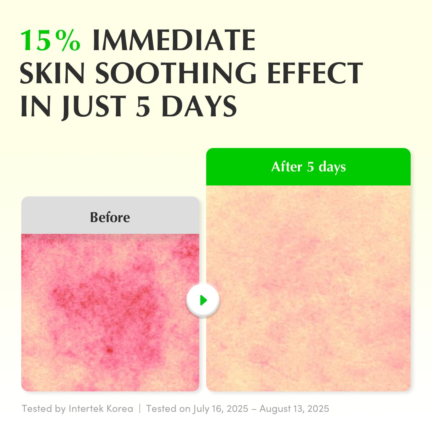 EQQUALBERRY Aloe PDRN Calming Smoothie Serum – Soothing Korean Skin Care for Sensitive Skin, Cica & Aloe for Repair, Hydrating & Radiant Glow, Non-Comedogenic (1.01oz / 30ml)