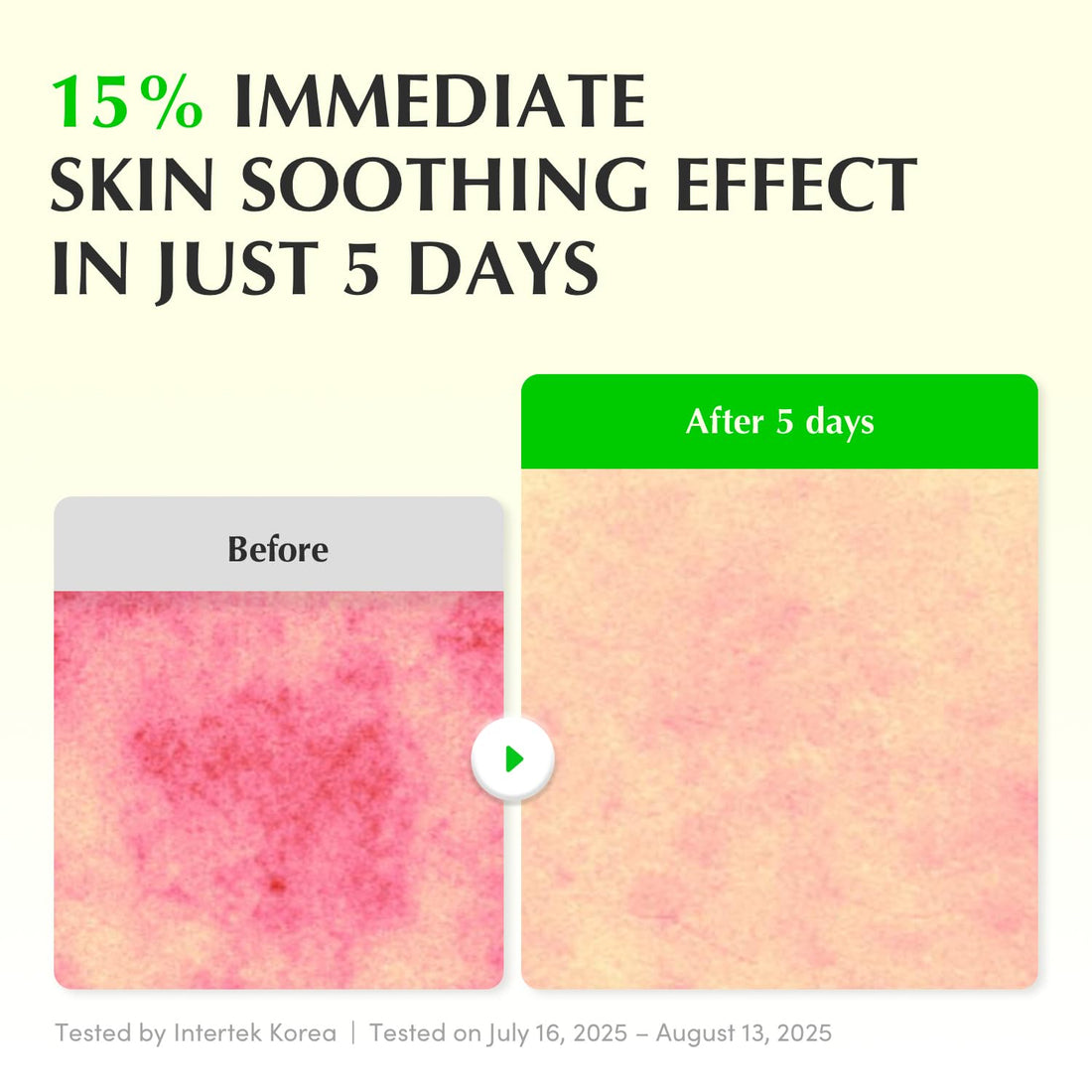 EQQUALBERRY Aloe PDRN Calming Smoothie Serum – Soothing Korean Skin Care for Sensitive Skin, Cica & Aloe for Repair, Hydrating & Radiant Glow, Non-Comedogenic (1.01oz / 30ml)