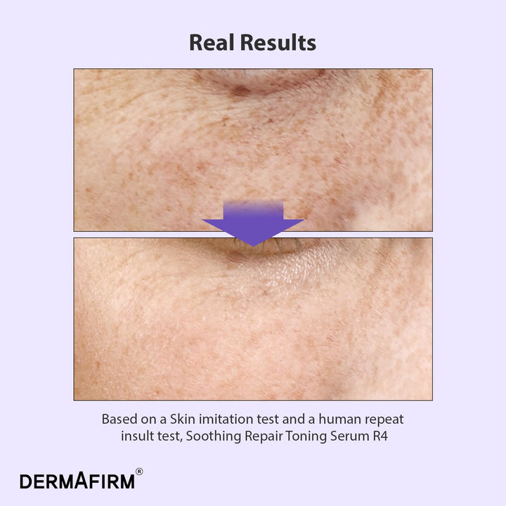 DERMAFIRM Soothing Repair Toning Serum R4 | Korean Bakuchiol Face Serum w/Niacinamide & Peptides | Calming and Correcting Facial Serum | No Animal Trials No Parabens 1.01 fl oz