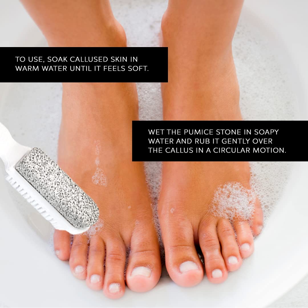 Foot Natural Bristle Brush & Pumice Stone Combo - Exfoliator Pedicures Calluses Remover - Smoother Body skin, feet, elbow Scrubber for Massage SPA Sauna by DreamCut