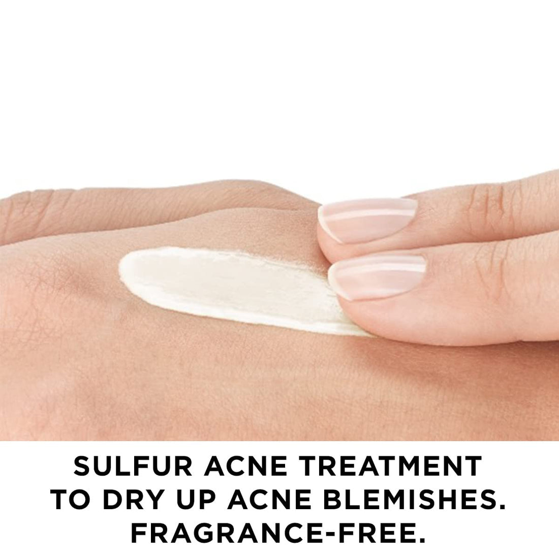 Vichy Normaderm S.O.S Acne Rescue Spot Corrector, Acne Spot Treatment for Face with 10% Sulfur, Niacinamide & Glycolic Acid, Suitable for Sensitive Skin