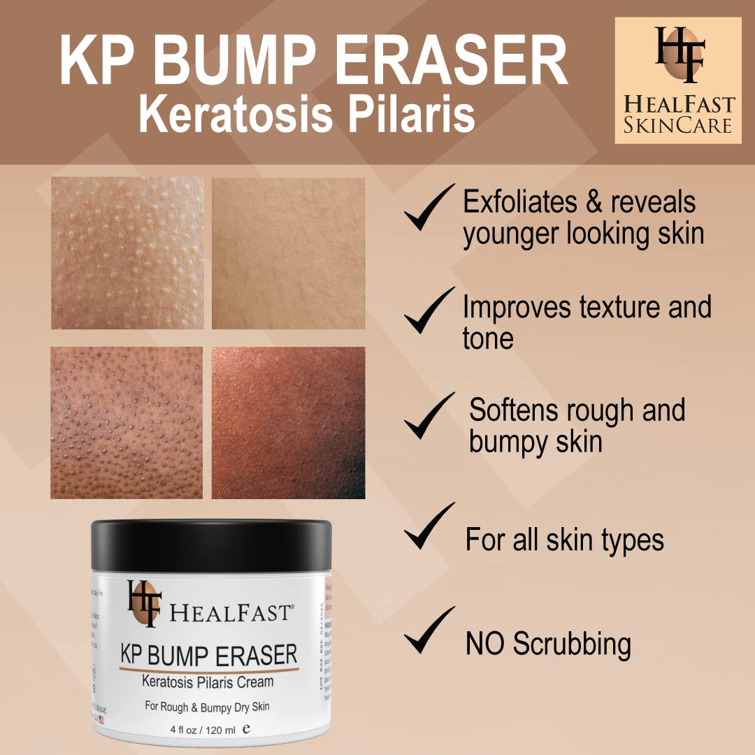 HealFast KP Bump Eraser Cream 4 Oz – Soften, Nourish Rough and Bumpy Skin with 2% BHA – Keratosis Pilaris - For All Types – No Scrubbing Required – Fragrance and Paraben Free