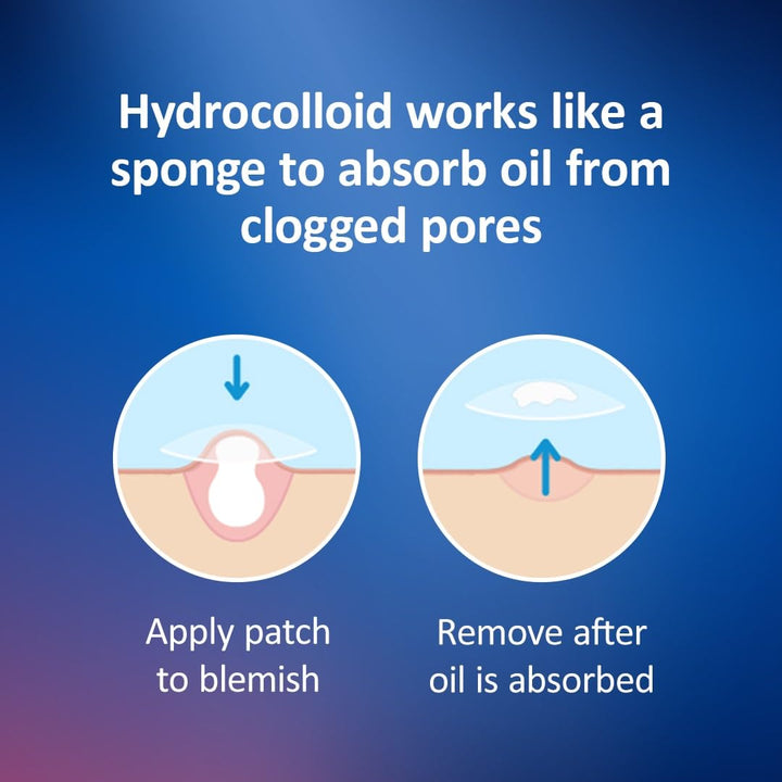 Nexcare Acne Patches, Pimple Patches for Face and Body, Hydrocolloid Patches Suitable for Most Skin Types - 108 Small and Medium Patches