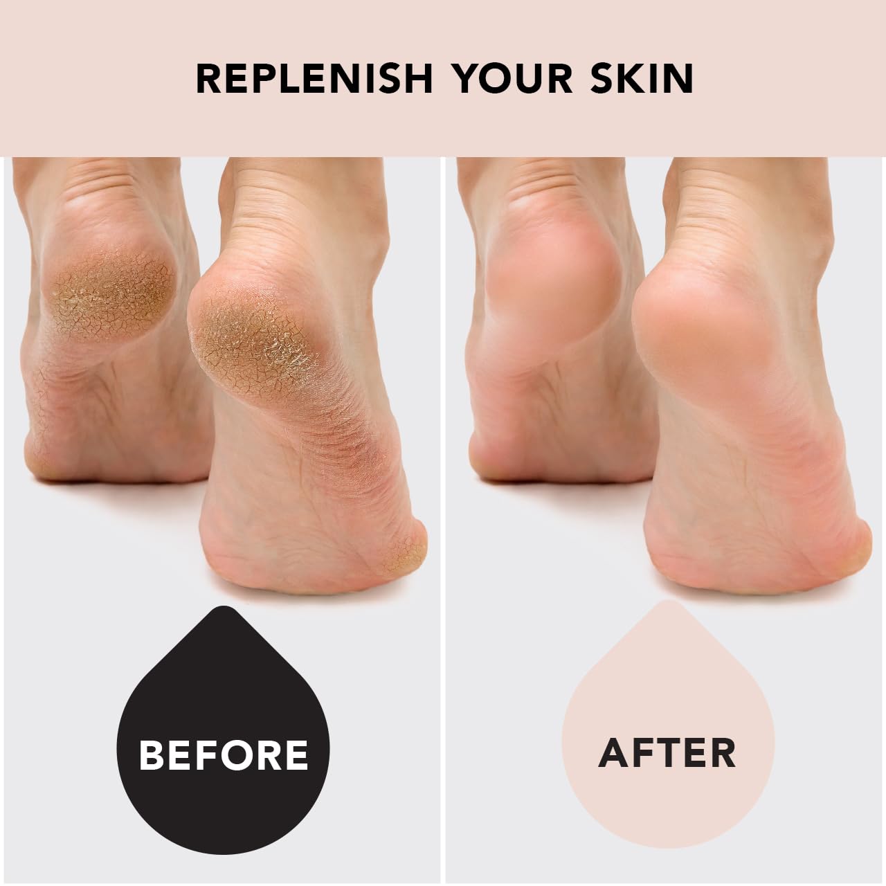 Kitsch Moisturizing Spa Socks, Moisturizing, for Heels & Feet