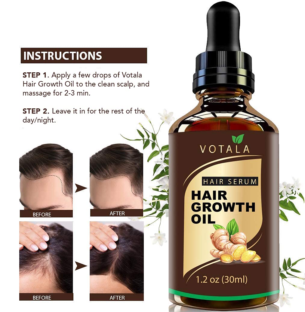 Hair Growth Serum, Votala Hair Growth Treatment, Hair Serum, Anti Hair Loss, Thinning, Balding, Repairs Hair Follicles, Promotes Thicker, Stronger Hair, And Promotes Hair Regrowth