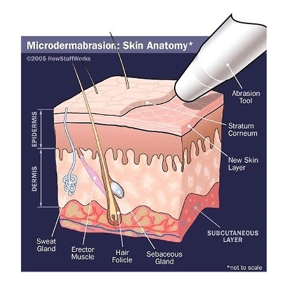 Microdermabrasion Crystals (4 lb, 120 Grit) All-Natural Rejuvenating Skin Face Exfoliator Treatment for Dull or Dry Skin, Wrinkles, Blemishes, Acne Scars & More by NeedCrystals