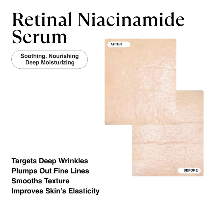 MATKAS Korean 0.05% Retinal + 5% Niacinamide Serum for Wrinkles - 1.01 Fl. Oz. Korean Retinol Serum for Face Anti Aging, Best Retinol Infusion for Face Wrinkles Dark Spots, Night Treatment