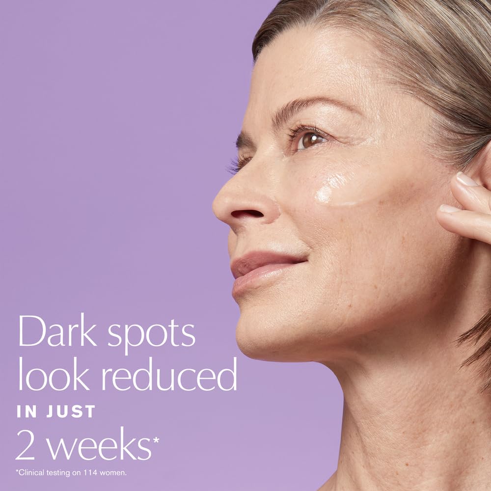 Estée Lauder Perfectionist Pro Rapid Brightening Treatment Face Serum with Ferment3 + Vitamin C| Targets Dark Spots, 1 Fl Oz