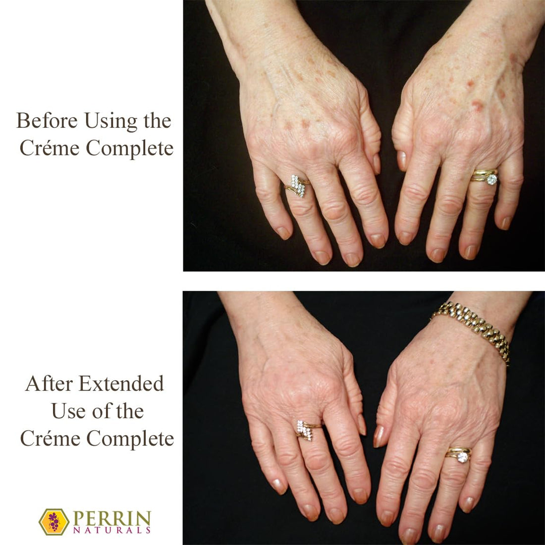 Creme Complete- All Natural, Restorative & Anti-Aging skin care. A Corrective Moisturizer for Sun Damage, Lichen Sclerosus, and Wrinkles. by Perrin Naturals¤Ä