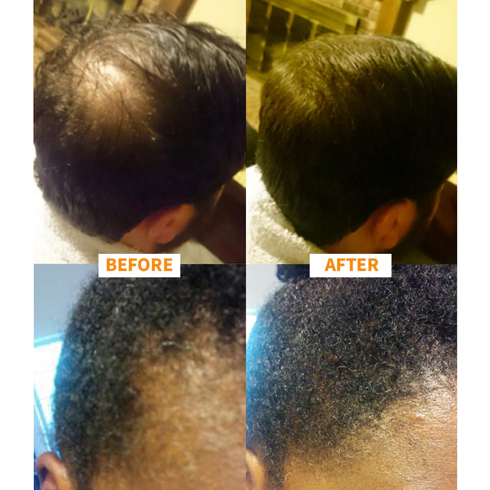 Auburn : Nor1 Hair Fibers [BEST VALUE] - Auburn 25g (90 day supply)