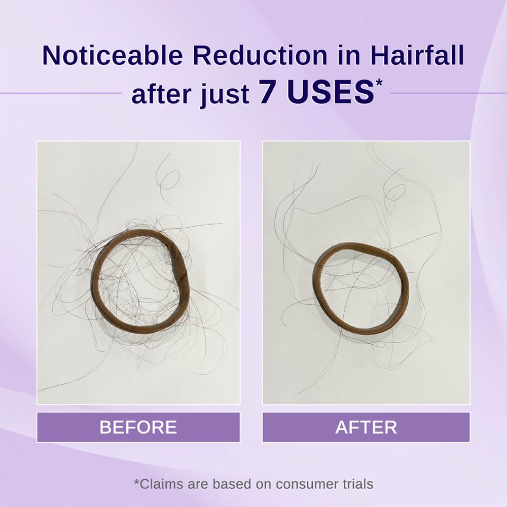 Bare Anatomy Nature x Science Rosemary Hibiscus Hair Growth Oil for Women & Men | Helps Hair Growth & Strengthens Hair | Nourishes Scalp & Controls Hair Fall | Suitable for All Hair Types-100ml