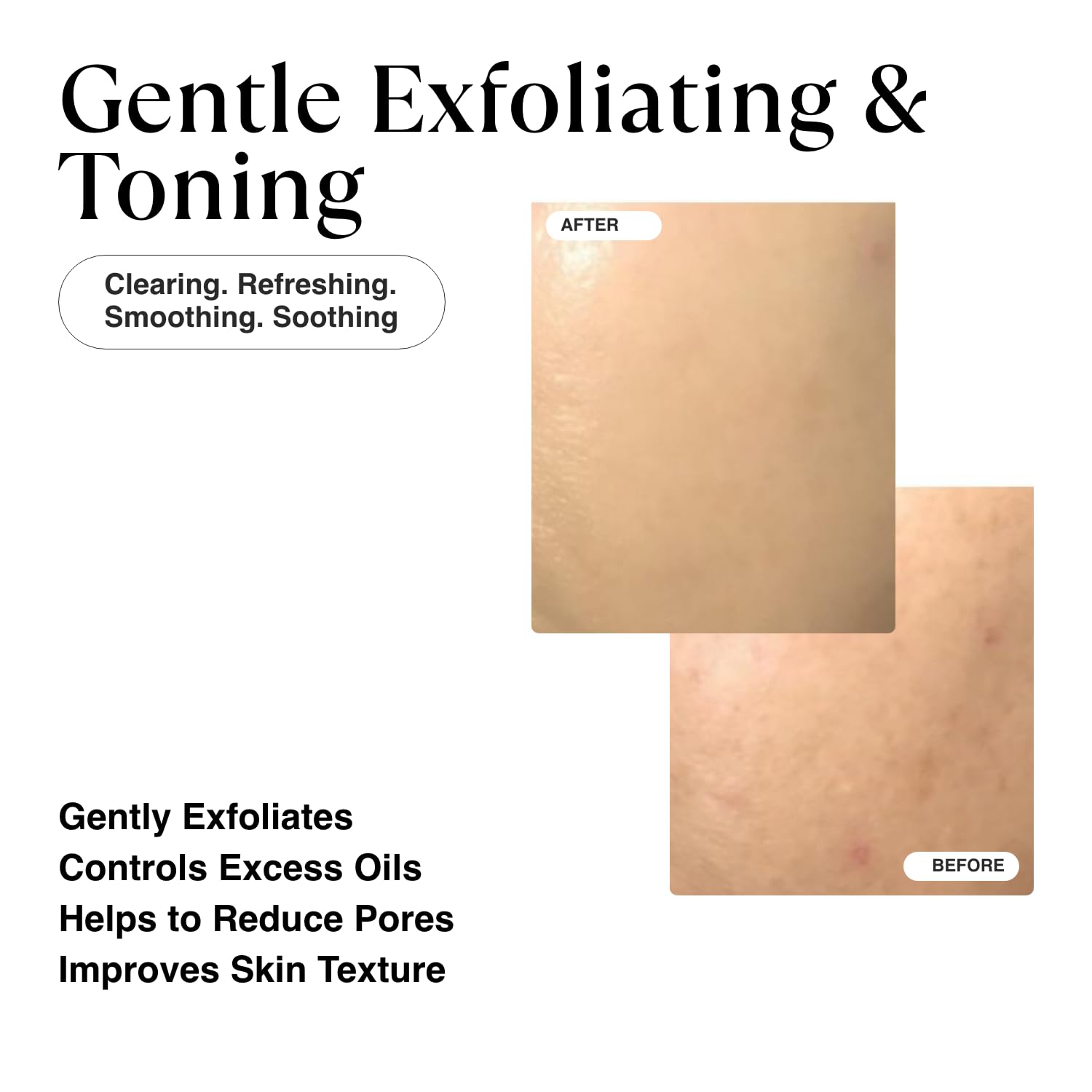 MATKAS Korean Exfoliating Toning Pads with Witch Hazel - 60 pads, Korean Toning Pads for Acne Prone Skin, Toner for Dry Sensitive Skin, Gentle Exfoliating Discs for Face, Glycolic Acid Toner