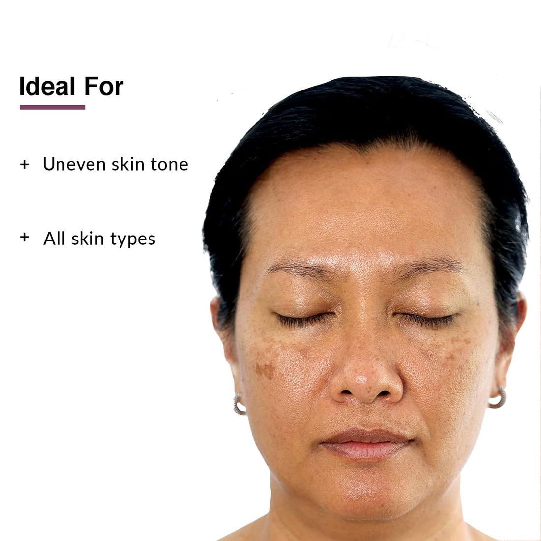 Fixderma 10% Tranexamic Acid Serum, Pigment Correcting Serum | Face Serum for Melasma, Hyperpigmentation & Acne Spots | Acne Serum | Face Serum for Men & Women - 30g