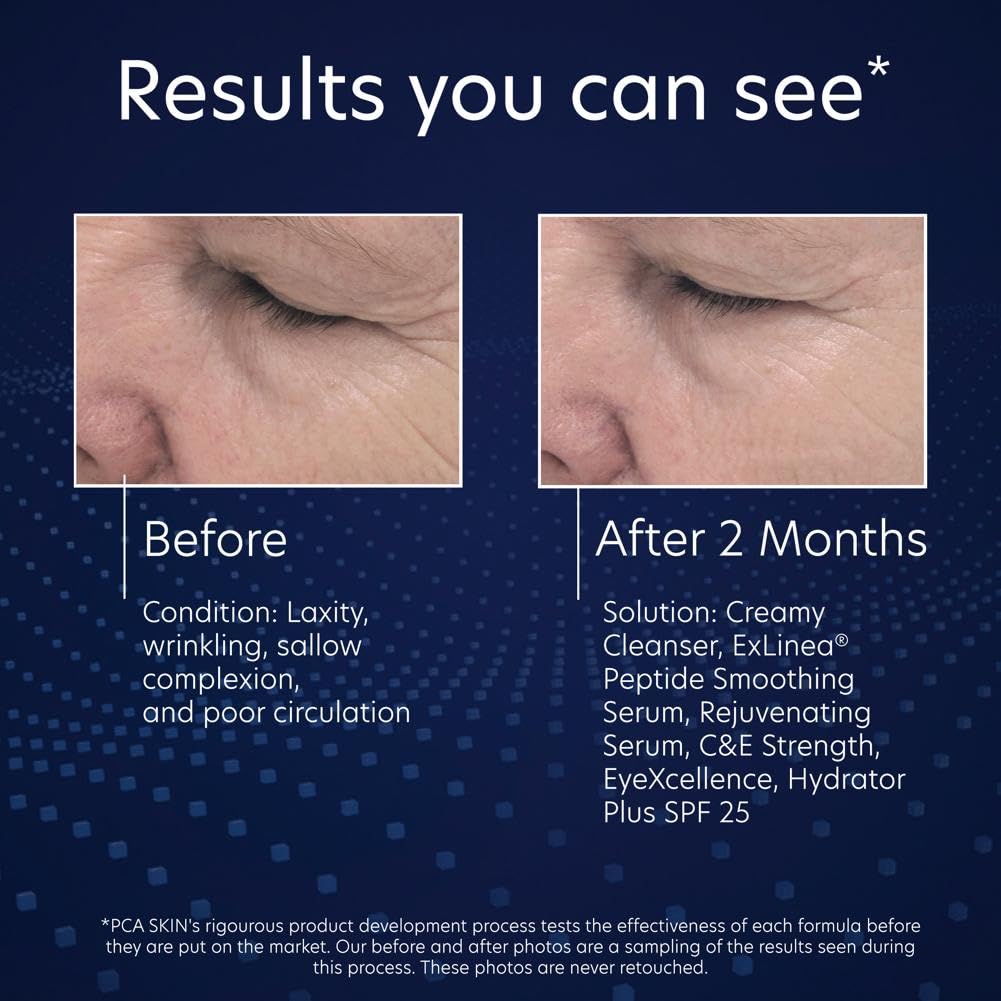 PCA Skin Exlinea Peptide Smoothing Serum (Phaze 25), 1 Fluid Ounce