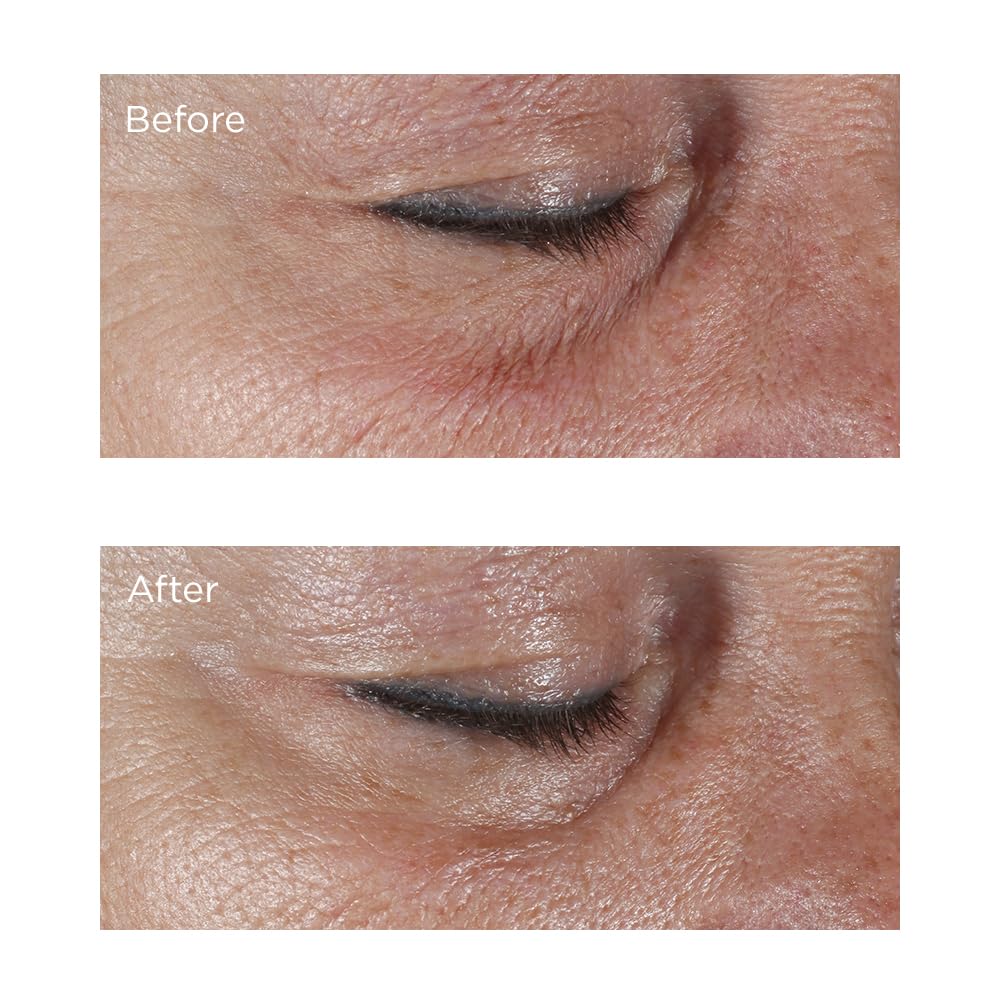 Hypoallergenic Firming Eye Cream by Perricone MD for Unisex - 0.5 oz Cream