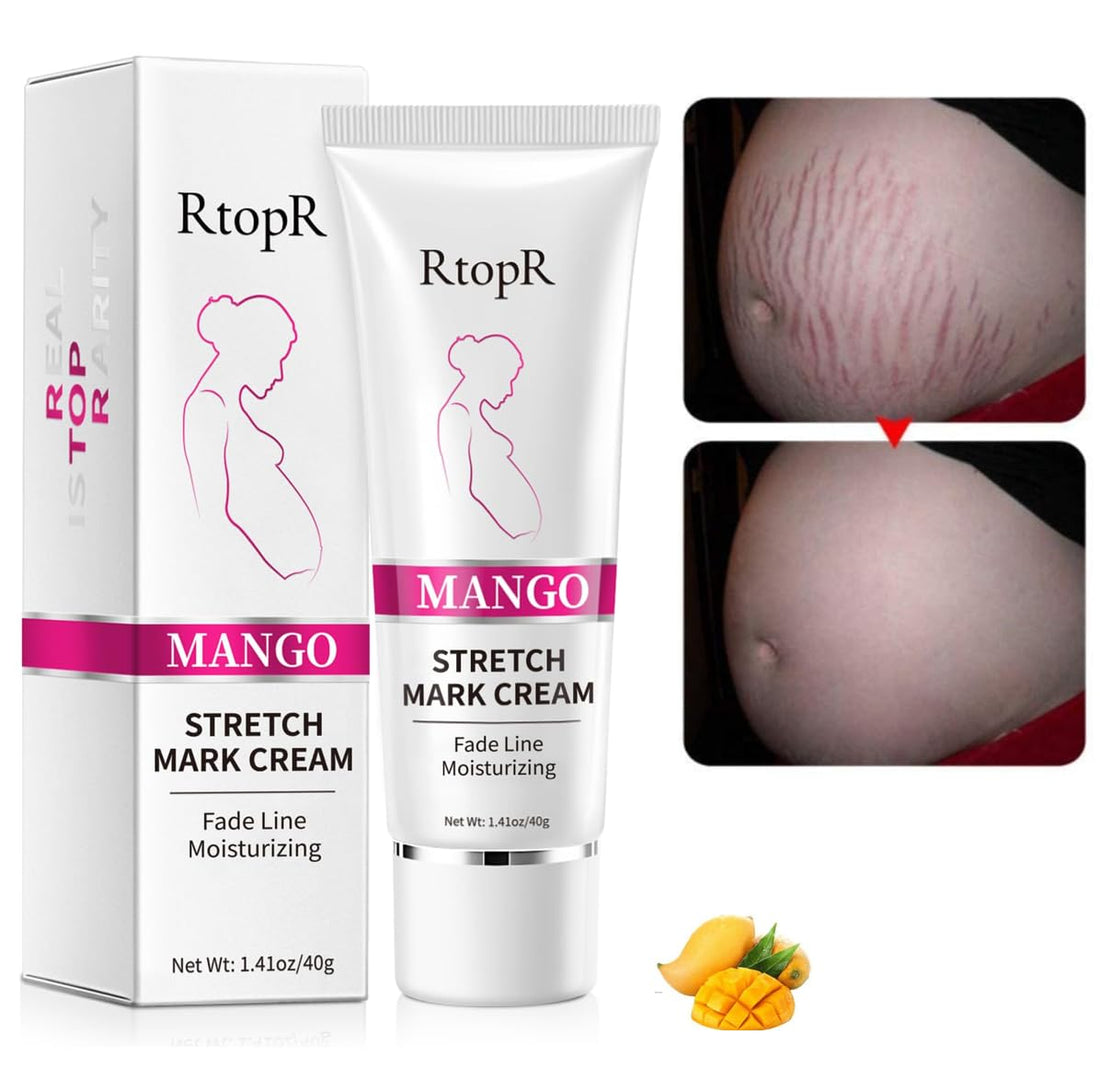 BIOKUSY Stretch Marks and Scar Cream, Stretch Mark and Scar Removal Cream for Pregnancy, Belly Creams for Wrinkles, Obesity Fat Marks Scars Moisturizing, Remove Marks(1 PCS)