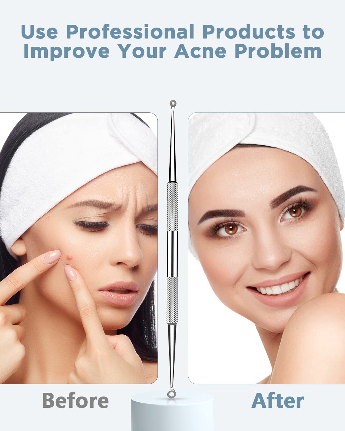 TAYTHI Bestope Blackhead Remover Pimple Acne Extractor Tool With Metal Case (Silver)