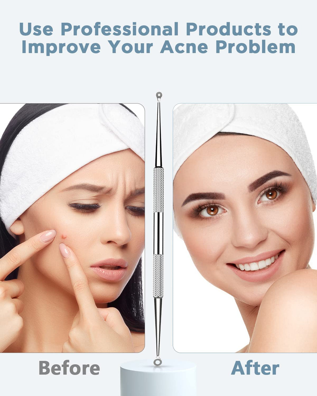 TAYTHI Bestope Blackhead Remover Pimple Acne Extractor Tool With Metal Case (Silver)