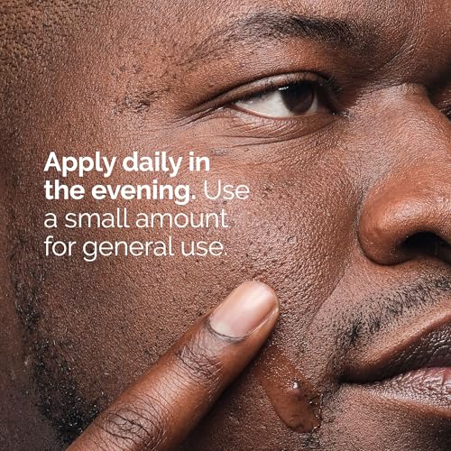 The Ordinary Salicylic Acid 2% Solution, Acne-Fighting Serum for Blemish-Prone Skin, 1 Fl Oz