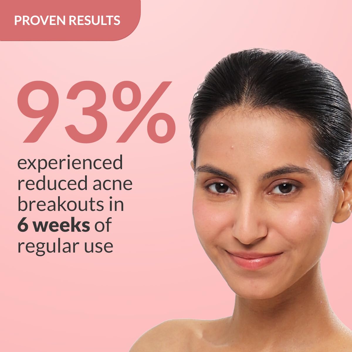 Fixderma 2% Salicylic Acid Serum for Anti Acne & Spot Treatment with 5% Azelaic Acid & 4% Mandelic Acid | Anti Acne Face Serum | Face Serum for Men & Women | Face Serum for Oily Skin - 30g