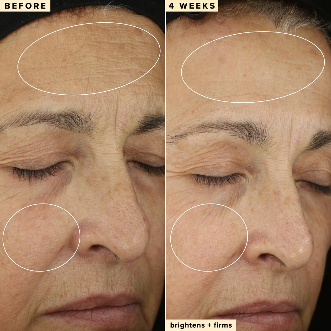 Farmacy 10% Vitamin C Serum for Face - Brightening Vitamin C Face Serum to Firm + Smooth Skin Texture - L Ascorbic Acid + Tangerine Peel Infused Skin Care to Hydrate and Even Skin Tone (30ml)