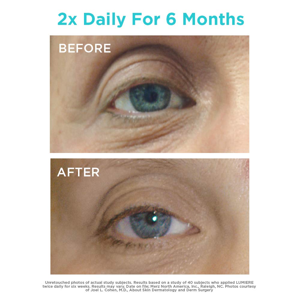 NEOCUTIS LumiÃƒ¨re Bio-restorative Eye Cream