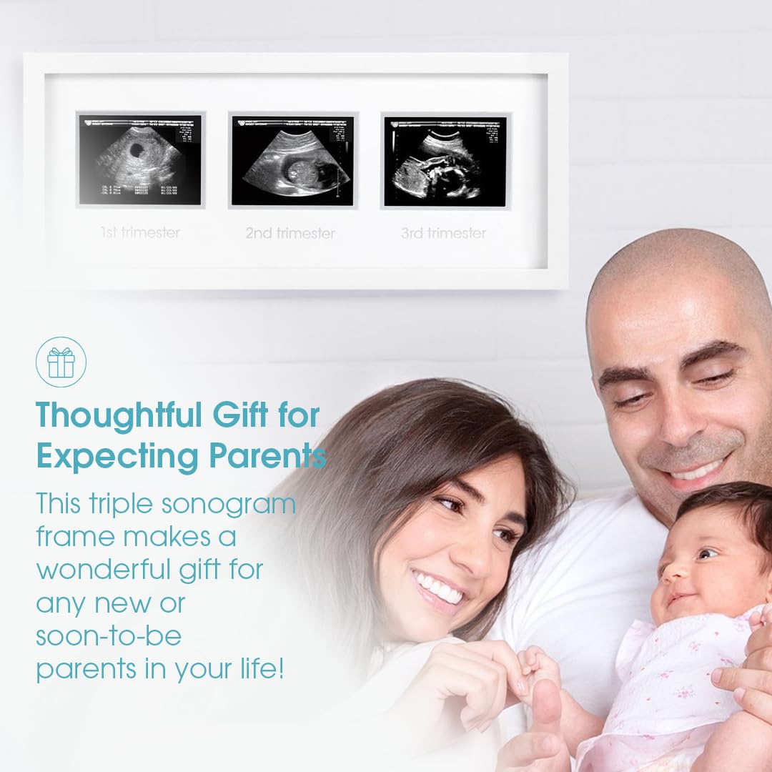 Pearhead Sonogram Progression Frame - Trimester by Trimester Pregnancy Milestone Keepsake, Gender-Neutral Nursery Decor, Displays 1st, 2nd & 3rd Trimester Ultrasound Photos, White