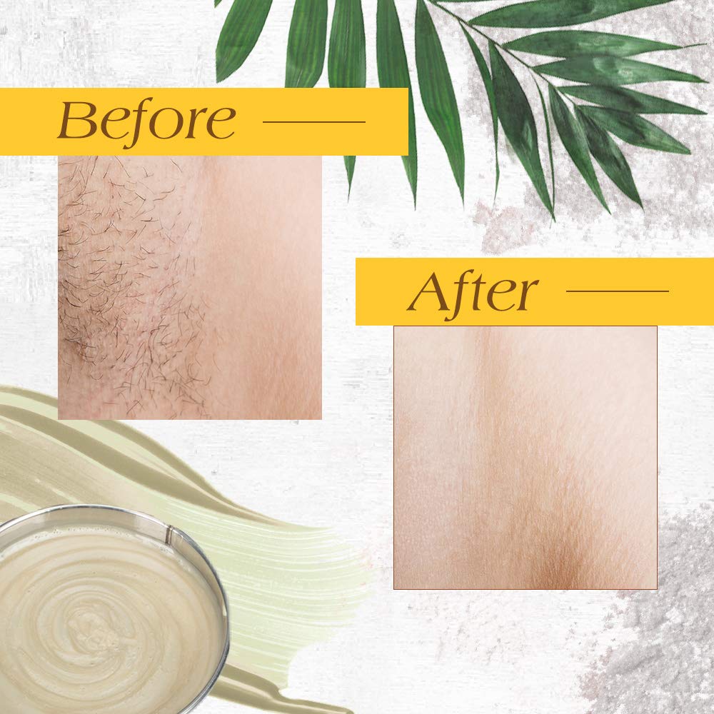 GiGi Zinc Oxide Hair Removal Wax for Ultra-Sensitive Skin, Gentle Formula for Face & Body, Soft Wax for Delicate Skin, 13 oz, 1 Pack