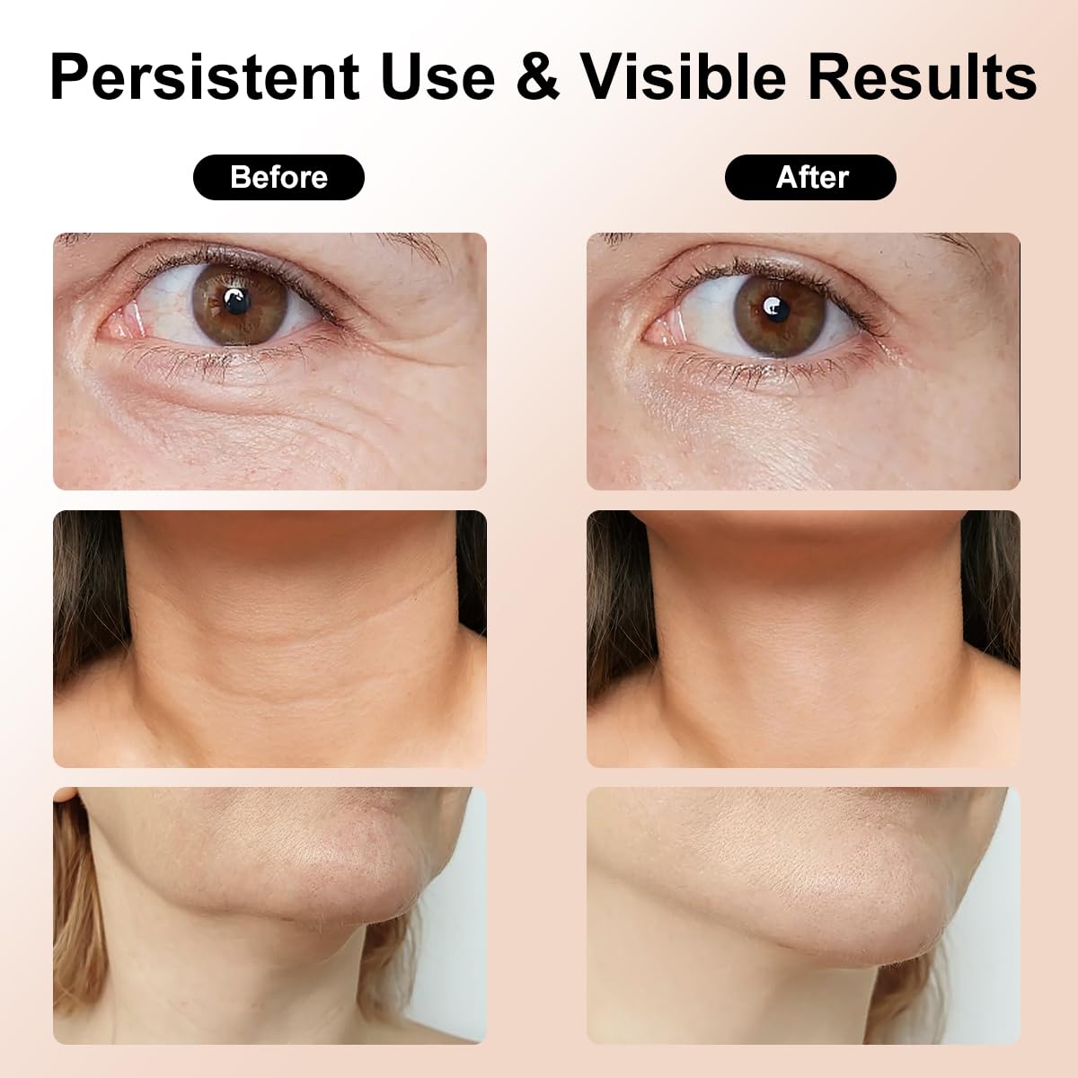 Facial and Neck Massage Kit, Neck Face Tightening Device, 3 Massage Modes for Skin Care at Home (Black)