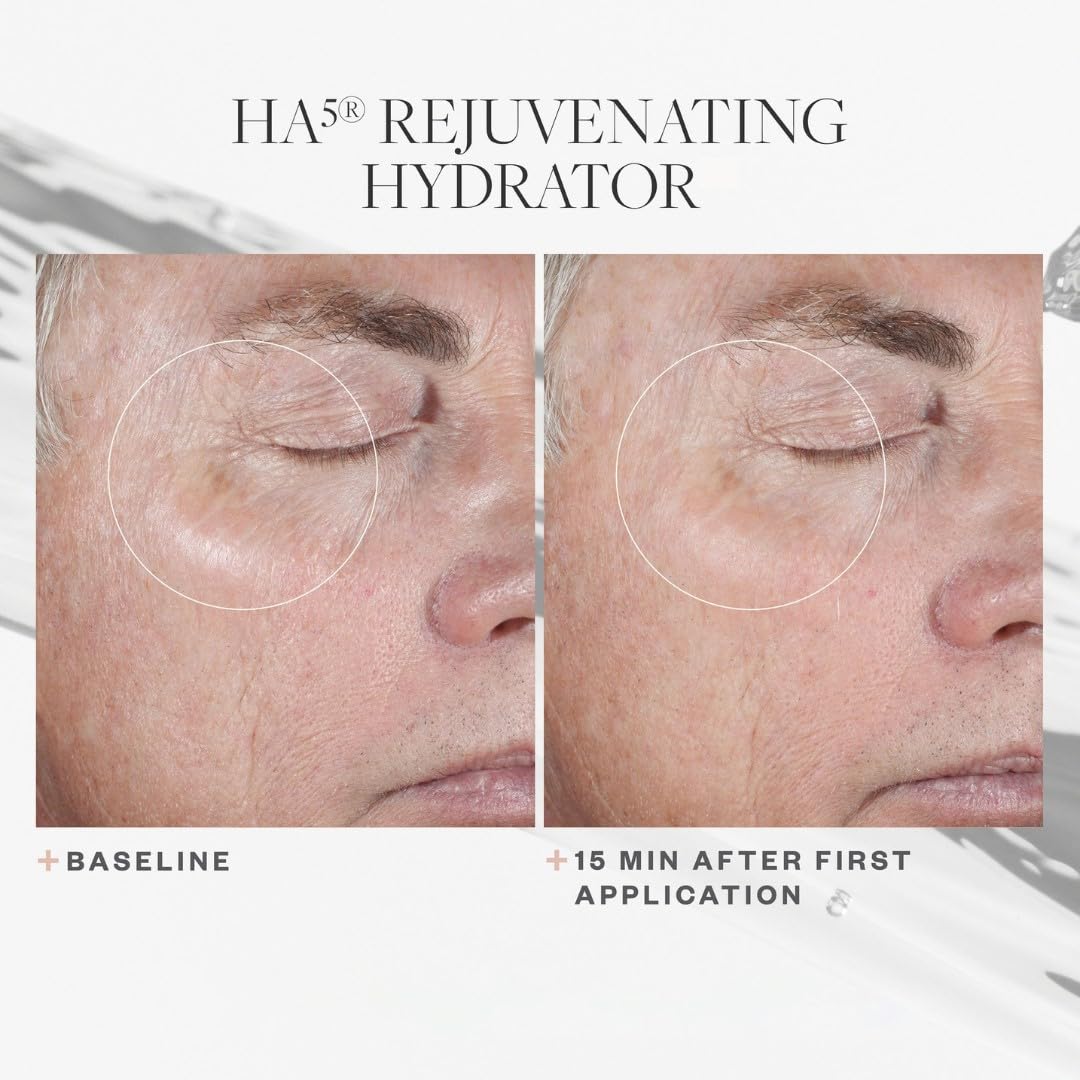 SkinMedica HA 5 Rejuvenating Hydrator Full Size 2oz