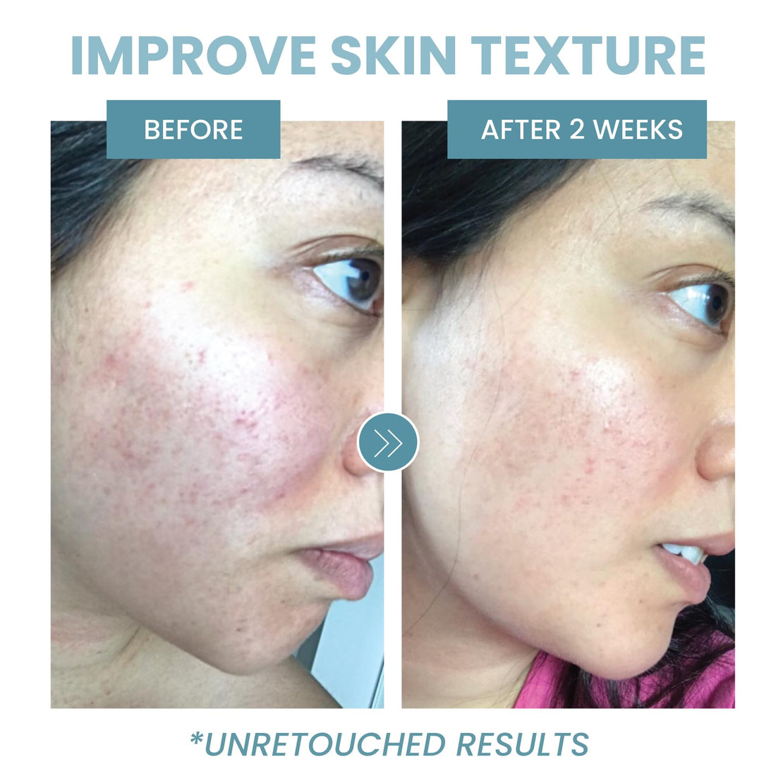 Eva Naturals Collagen Peptide Serum - Anti-Aging, Dark Spot Corrector, Skin Hydrator, Unisex, 2 oz