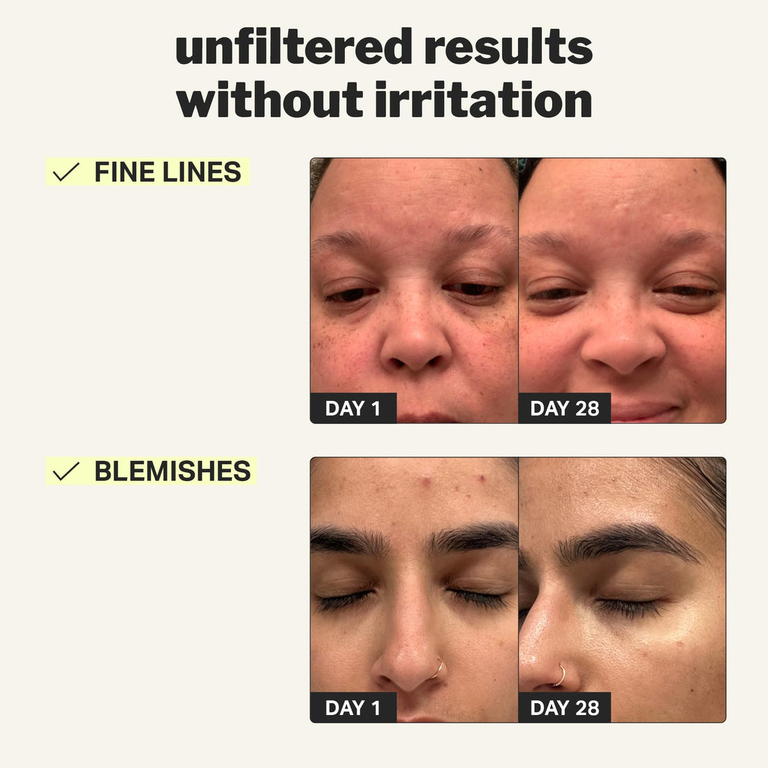Cocokind Beginner Retinol Gel 0.1%, Improve the Appearance of Fine Lines and Uneven Texture without Irritation, Aloe and Cica to Prevent Dryness, 1 fl oz