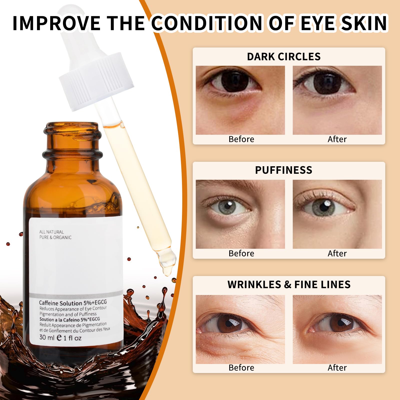 Caffeine Eye Serum with EGCG, 5% Caffeine Solution for Eyes Reduces Pigmentation and Puffiness, Under Eye Serum for Dark Circles, Under Eye Bags, Wrinkles and Fine Lines, 1 OZ