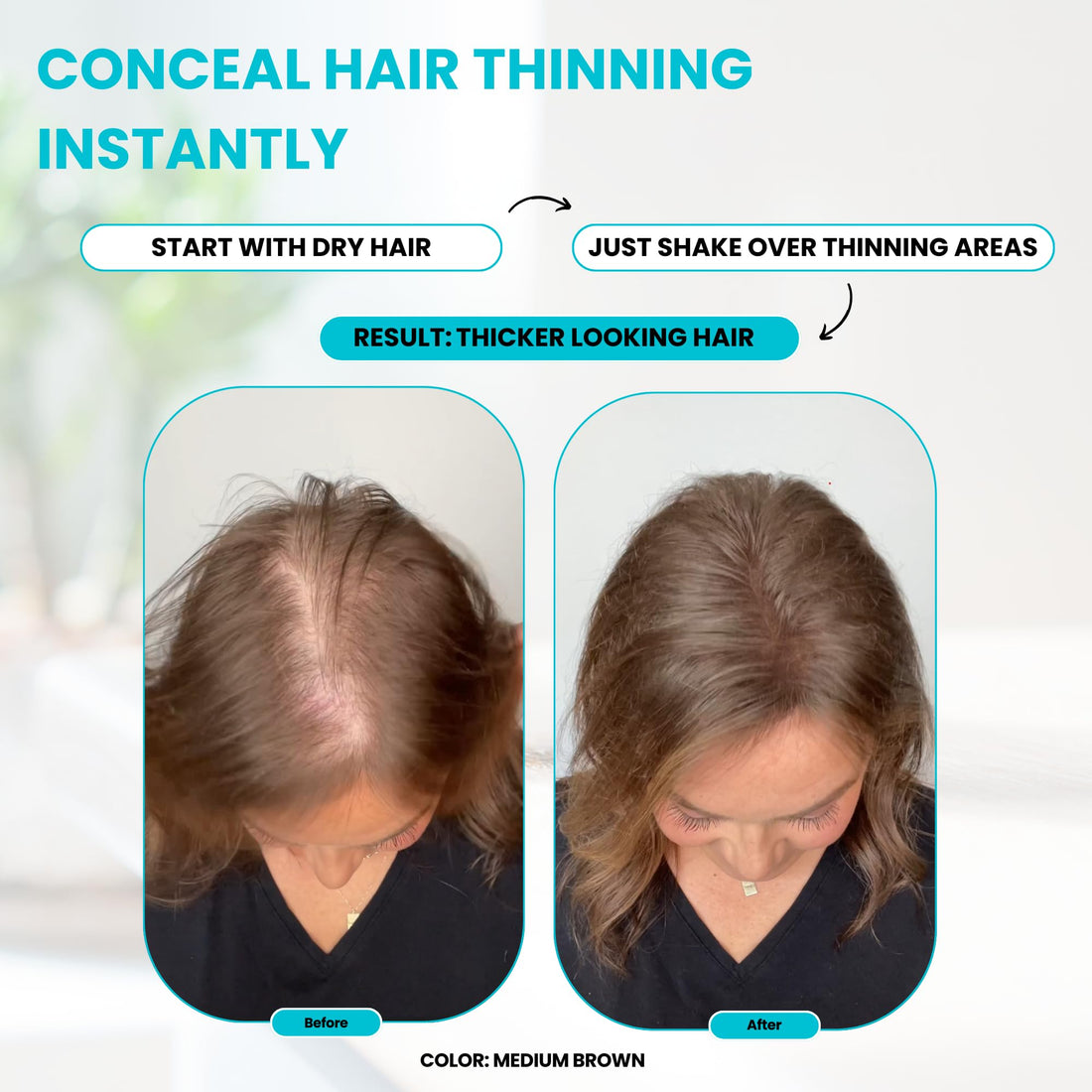 SureThik Hair Thickening Fibers - 30g - Natural - High Performance Hair Loss Concealer - Does Not Run When Wet (Medium Brown)