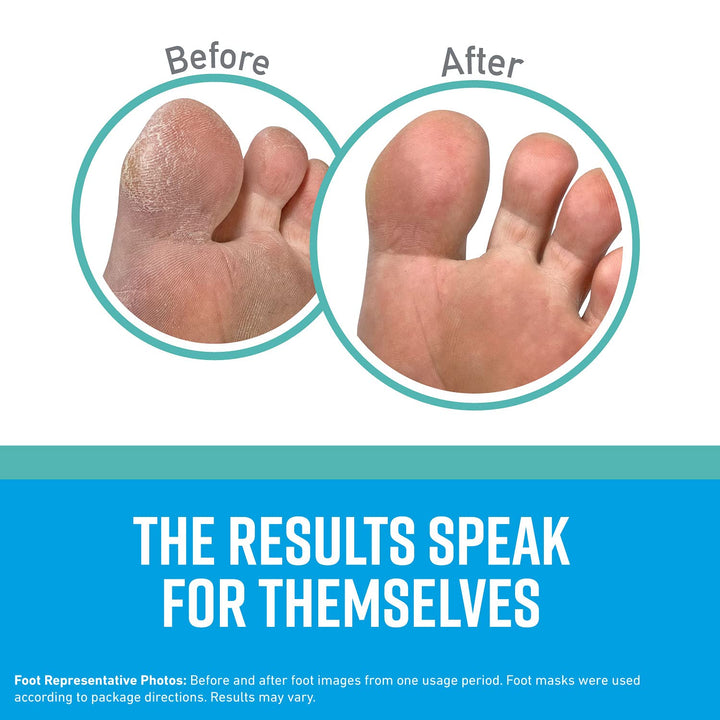 O'Keeffe's for Healthy Feet Intensive Moisturizing Foot Mask; Guaranteed Relief for Extremely Dry; Rough Feet; One Pair Single-Use Hydrating Foot Mask Socks; (Pack of 4)
