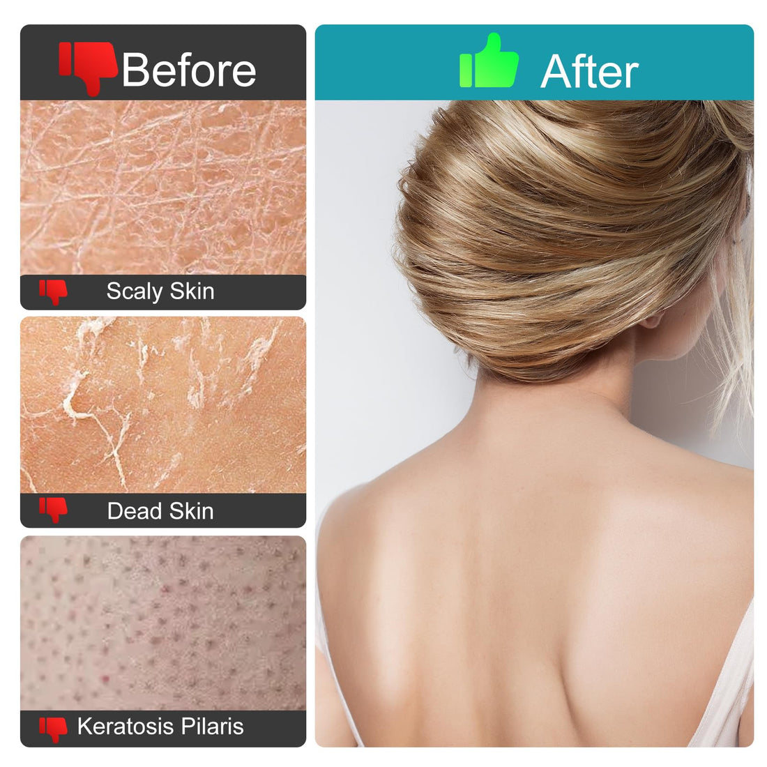 LCOCWMY Exfoliating Gloves, (4pcs) Durable Body Scrub, Dead Skin Remover & Body Scrubber Exfoliator, Body Exfoliating Gloves for Shower, washcloth exfoliating, exfoliating Glove for Smooth Skin