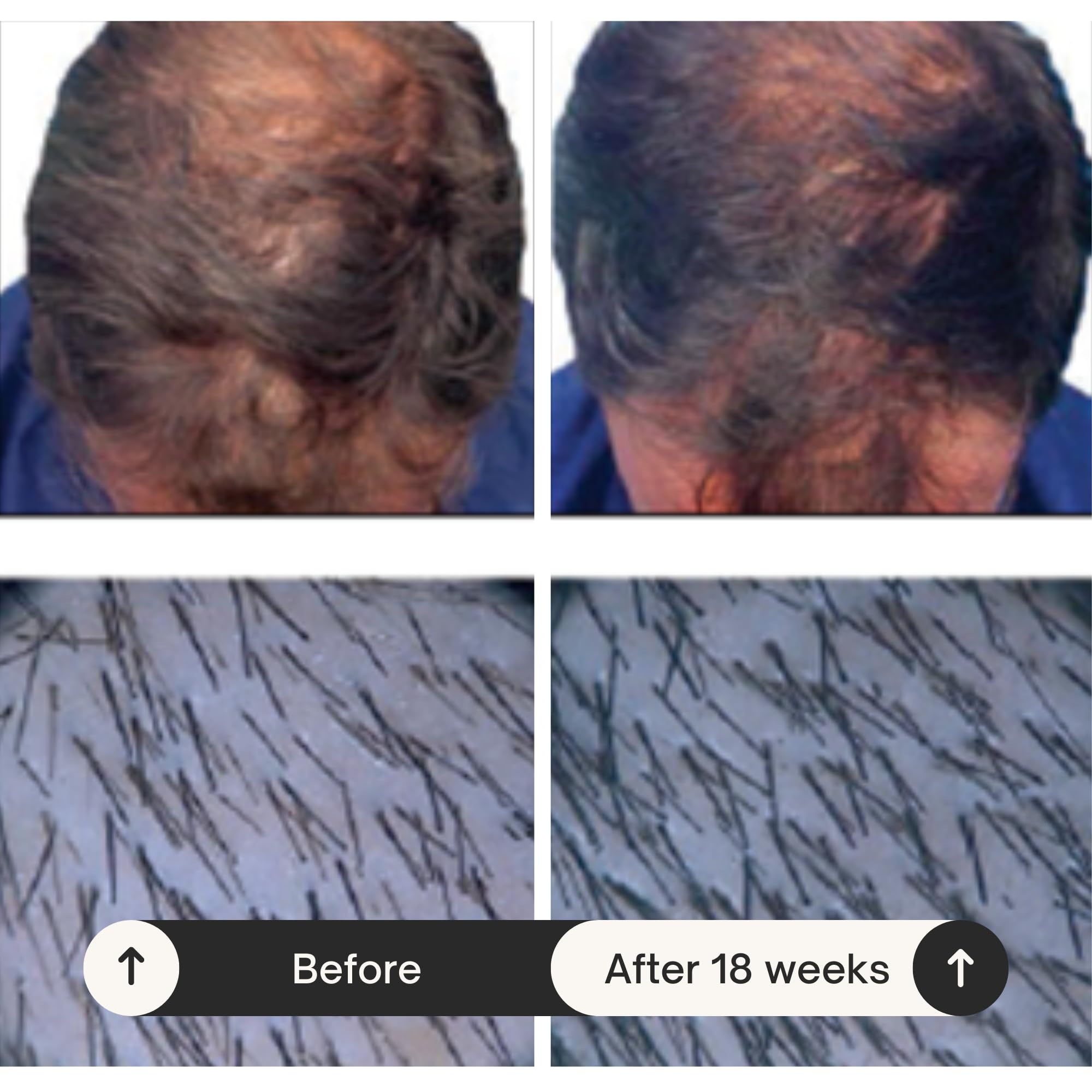 RAUSCH Ginseng Caffeine Shampoo 200 ml