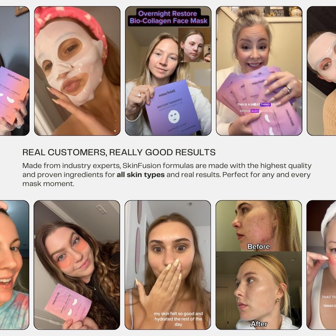 SkinFusion Collagen Under Eye Mask Patches (Anti-Aging + Firming, 20 Pairs) with Niacinamide + Peptides for Anti-Aging, Reduce Fine Lines, Wrinkles, Dark Circles, Puffy Eyes, Under Eye Bags - K Beauty